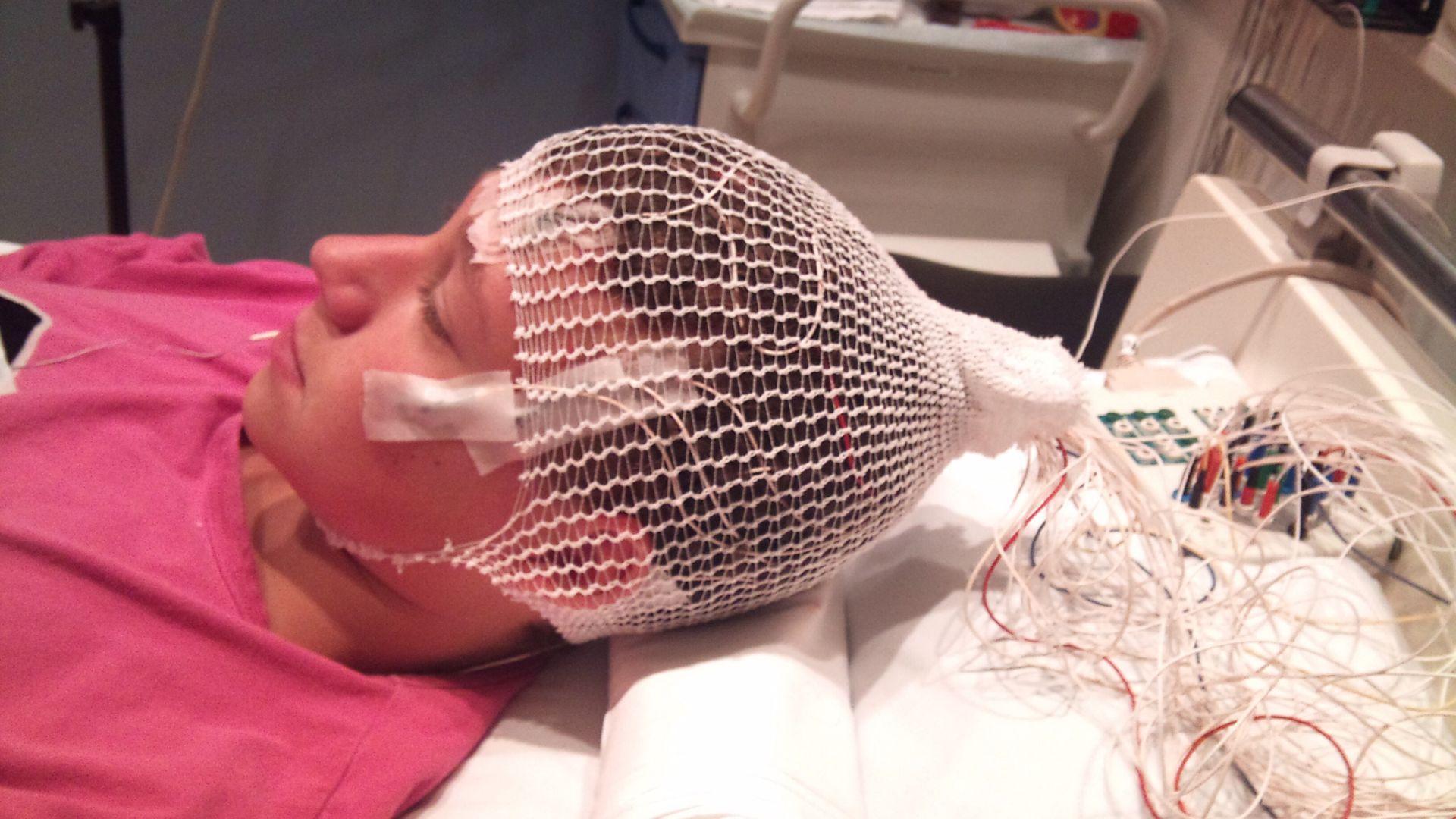 ect-treatment-for-depression-Santa-Ana