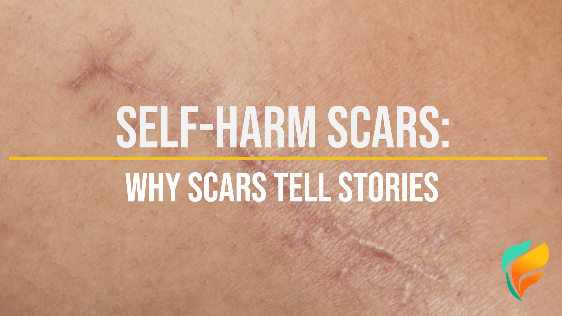 What Are Self-Harm Scars? Self-harm scars tell stories. Some are about people in crisis...and some can mean resilience.