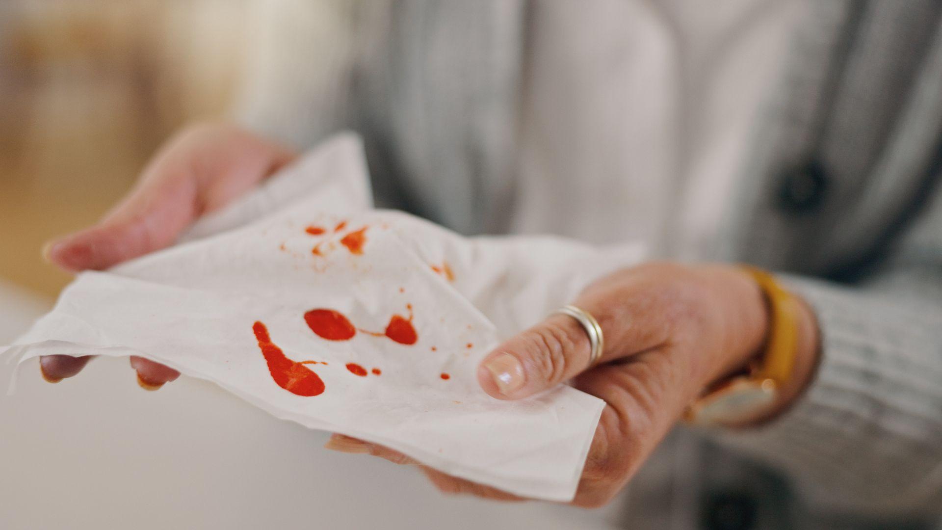 why am i bleeding after drinking alcohol napkin with blood on it