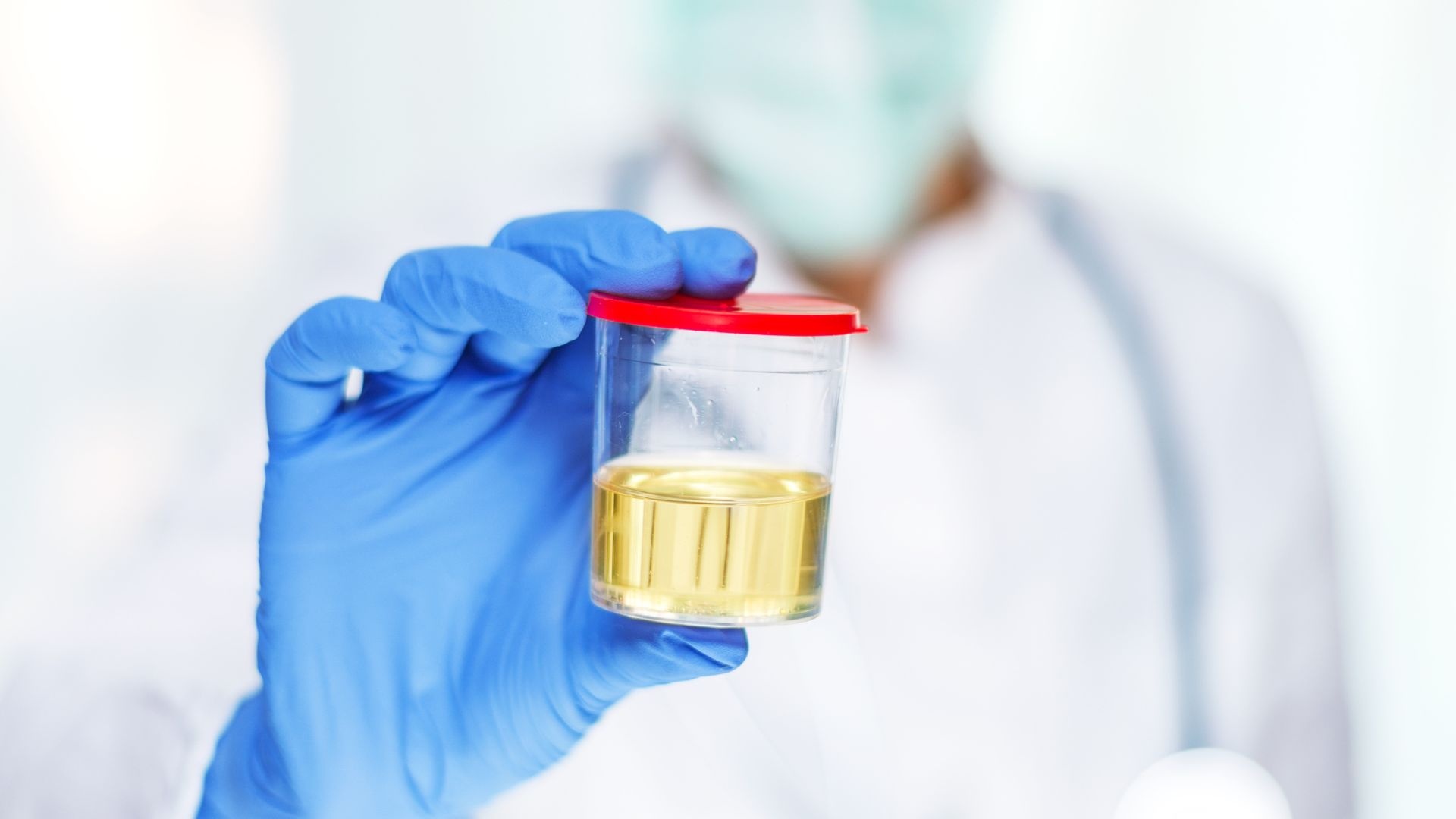 how long does oxycodone stay in your urine: Doctor holding urine sample how long does oxycodone stay in your urine: Doctor holding urine sample